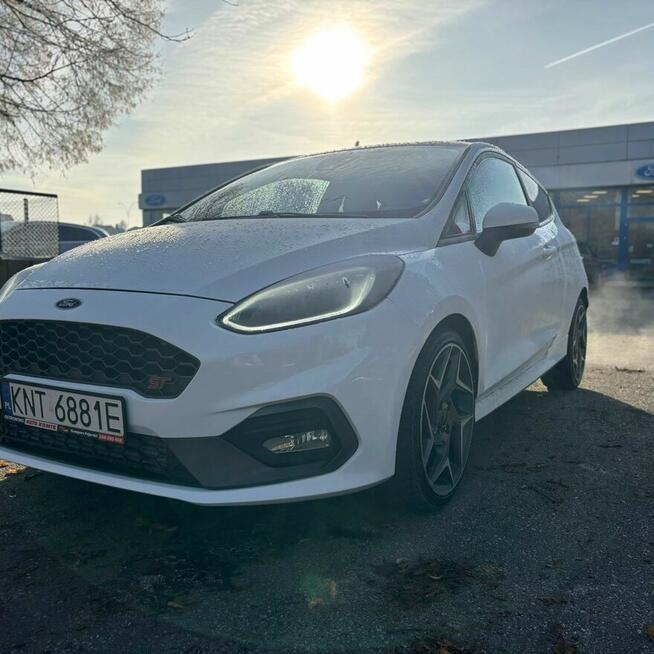 Ford Fiesta ST
