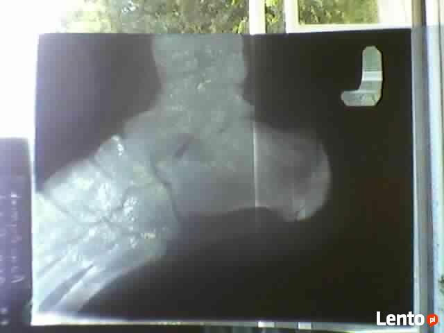 KUPIĘ wyroby ze srebra oraz klisze RTG 506-348-194