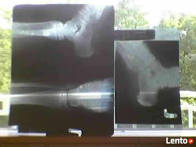 SKUP KLISZ, BŁON,ZDIĘC RENTGENOWSKICH.RTG.tel.506-348-194