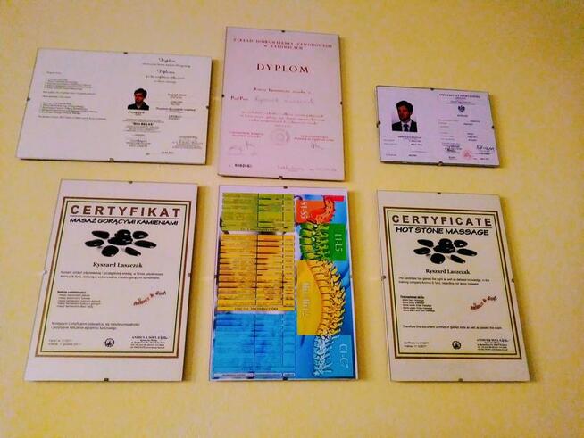 Rehabilitacja masaż, Hirudoterapia