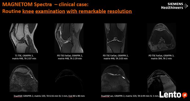 Rezonans Magnetyczny 3T-MAGNETOM Spectra 3T marki Siemens