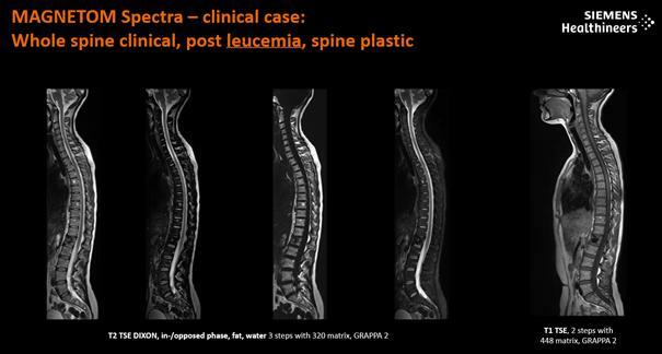 Rezonans Magnetyczny 3T-MAGNETOM Spectra 3T marki Siemens