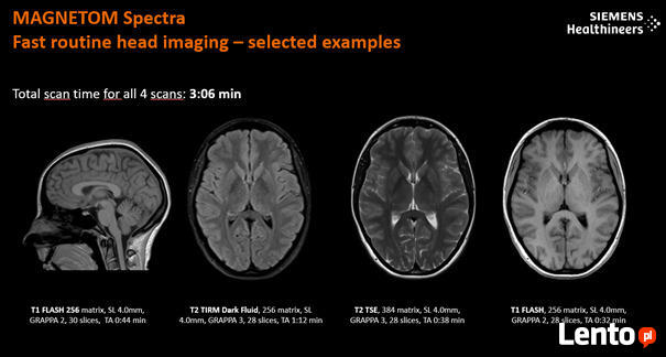Rezonans Magnetyczny 3T w Warszawie-MAGNETOM Spectra 3T mark