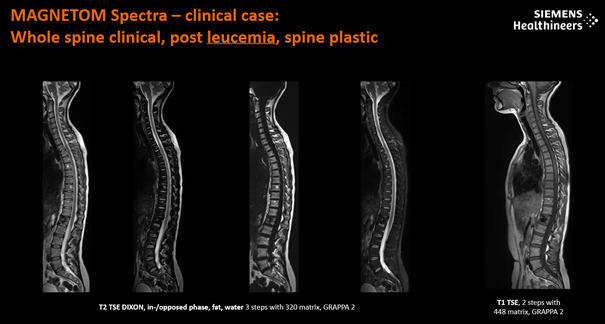 Rezonans Magnetyczny 3T w Warszawie-MAGNETOM Spectra 3T mark