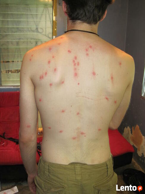 Zwalczanie Pluskiew Warszawa, Odpluskwianie, PLUSKWY