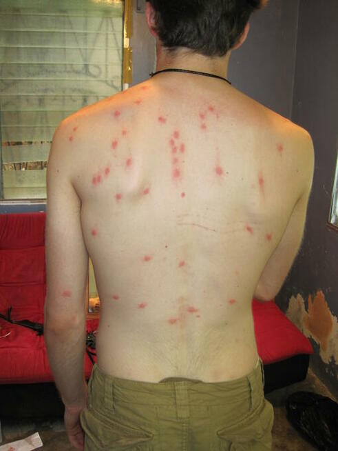 Zamgławianie na Pluskwy domowe. Odpluskwianie Warszawa