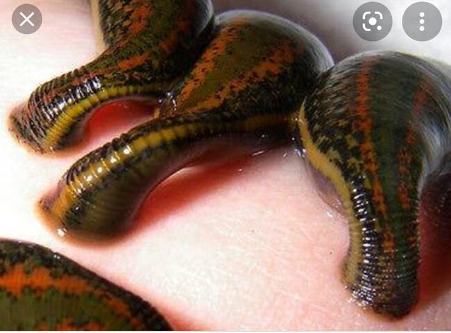 Pijawki. Hirudologia - leczenie pijawką lekarską.