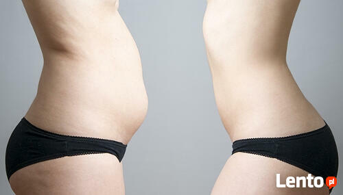 Liposukcja bez skalpela!Okazja250zł