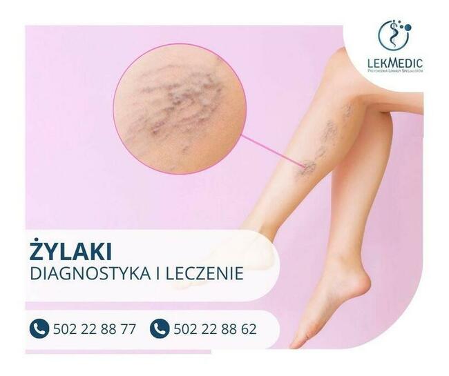 USG-Doppler - chirurg naczyniowy - Żyły i Tętnice