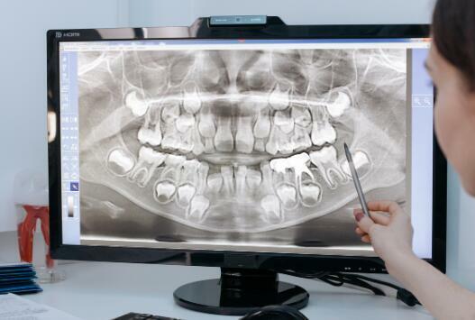 zdjęcie RTG Panoramiczne, pantomograficzne, Cefalometryczne