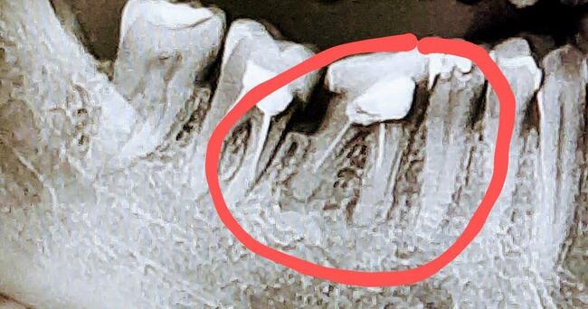 zdjęcie RTG Panoramiczne, pantomograficzne, Cefalometryczne