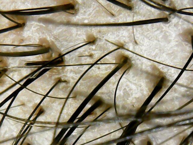 Trycholog Gdańsk - Gdańsk Przymorze