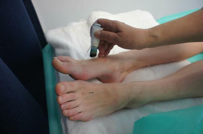 Akupunktura, medycyna naturalna-tybetańska-Gdańsk