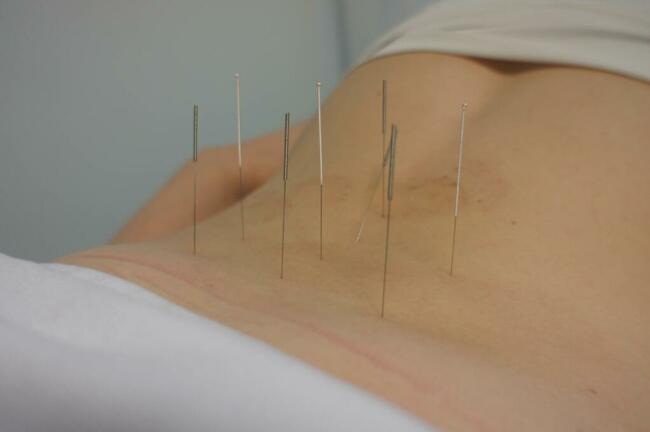 Akupunktura, medycyna naturalna-tybetańska-Gdańsk