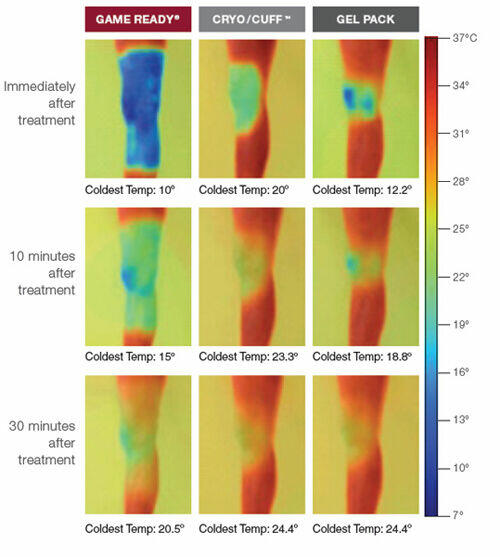 Game Ready wypożyczalnia wynajem pomoc od Fizjoterapeuty