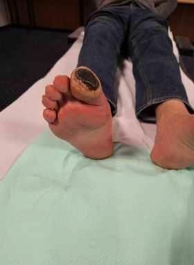 Pijawki lekarskie - Gabinet Hirudoterapii Lutomiersk