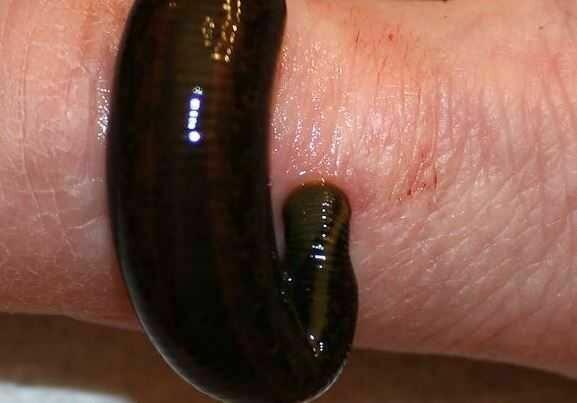 Pijawki lekarskie - Gabinet Hirudoterapii Lutomiersk