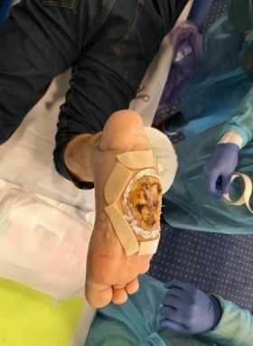 Pijawki lekarskie - Gabinet Hirudoterapii Lutomiersk