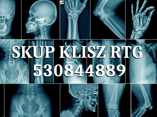 Skup klisz RTG