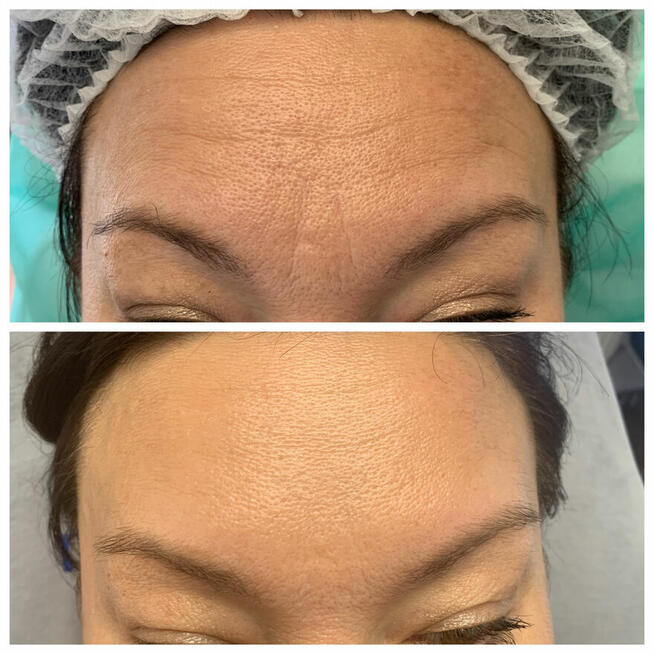 Venom innowacyjny krem + 40 % propolis dla pięknej cery