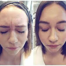 Venom innowacyjny krem + 40 % propolis dla pięknej cery