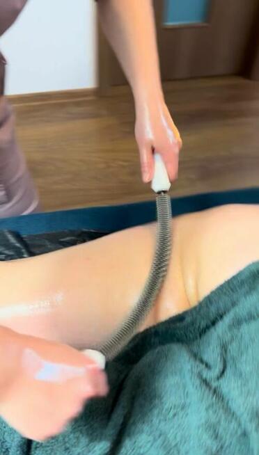 Masaż Antycellulitowy