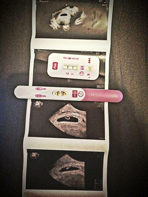 Para z Panią w Ciąży (31 tydzień) Szuka Pary lub Pani