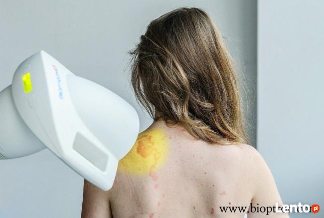 Lampy medyczne BIOPTRON