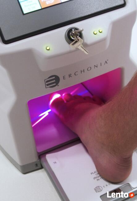 LASER - GRZYBICA - SKUTECZNIE POZNAŃ Tarnowo Podgórne