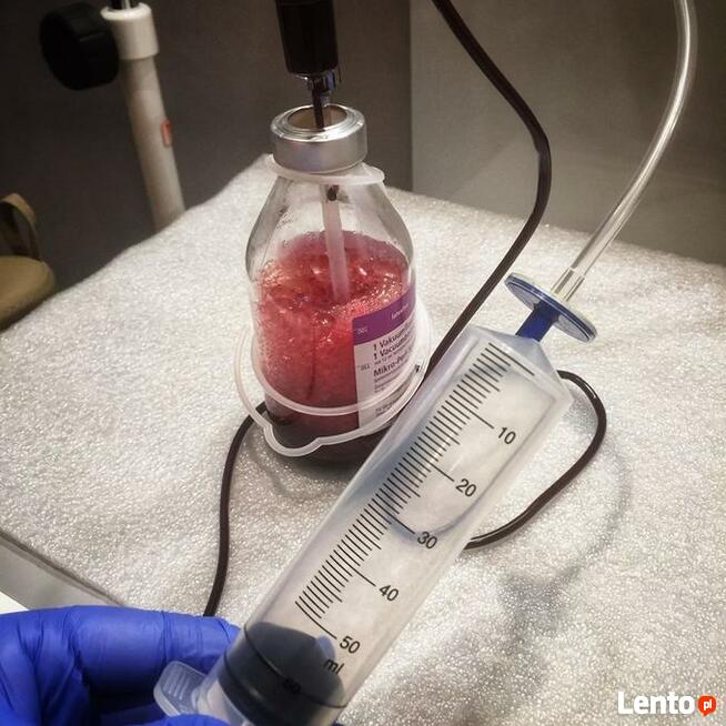 Ozonoterapia Warszawa