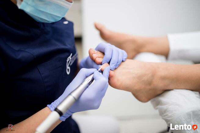 Profesjonalne oraz skuteczne terapie podologiczne.
