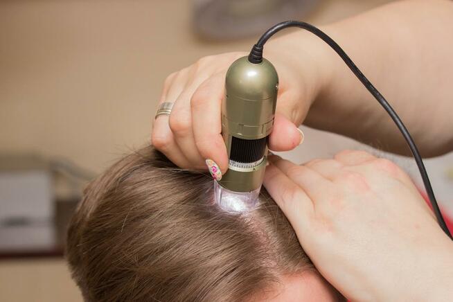 Trycholog łysienie łupież łojotok