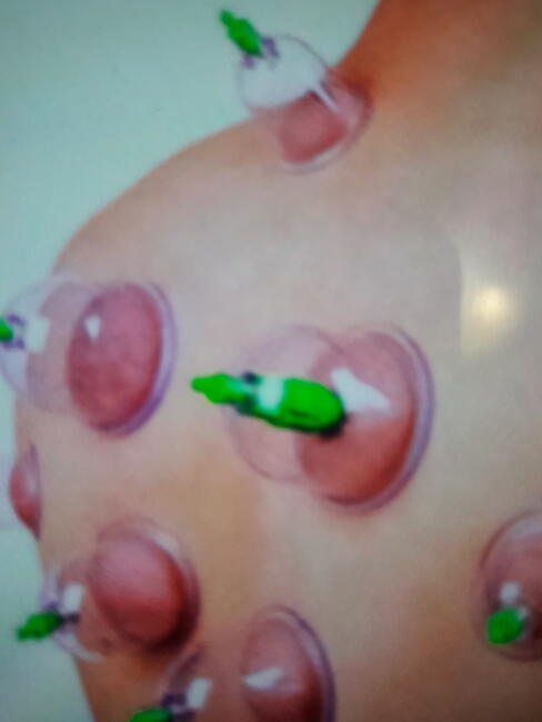 Profesjonalne masaże lecznicze