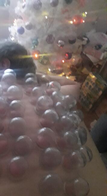 Profesjonalne masaże lecznicze