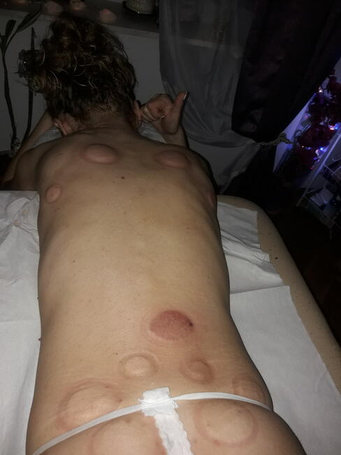 Profesjonalne masaże lecznicze