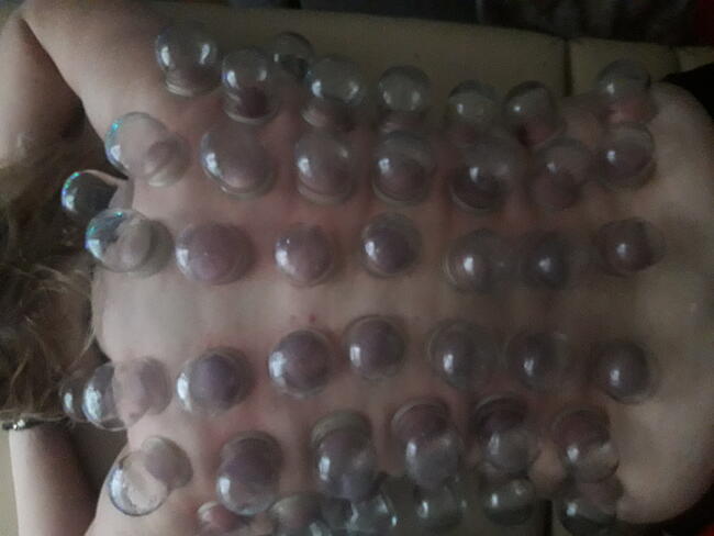 Profesjonalne masaże lecznicze