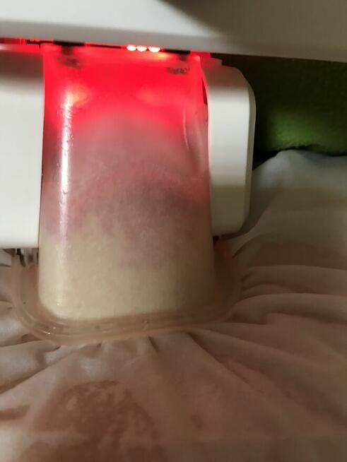 Kriolipoliza -chłodzenie tkanki tłuszczowej