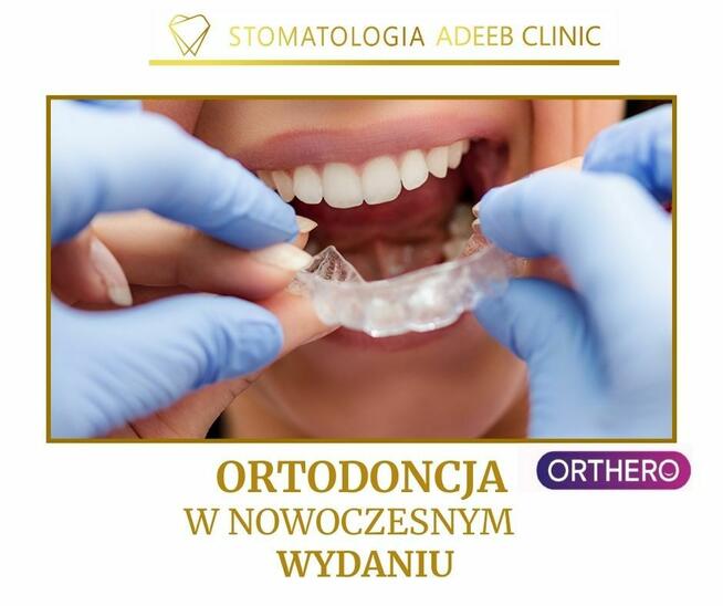 ortodoncja nakładki - SANDRA ADEEB Dąbrowa Górnicza