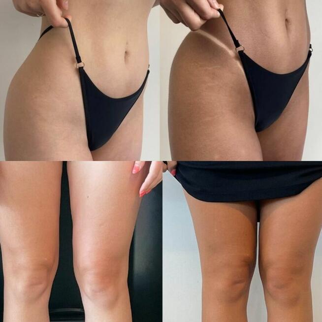 Opalanie natryskowe Pruszków