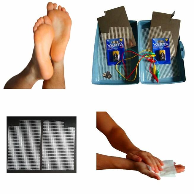 Jonoforeza przeciw nadmiernemu poceniu sie dłonie stopy ręce