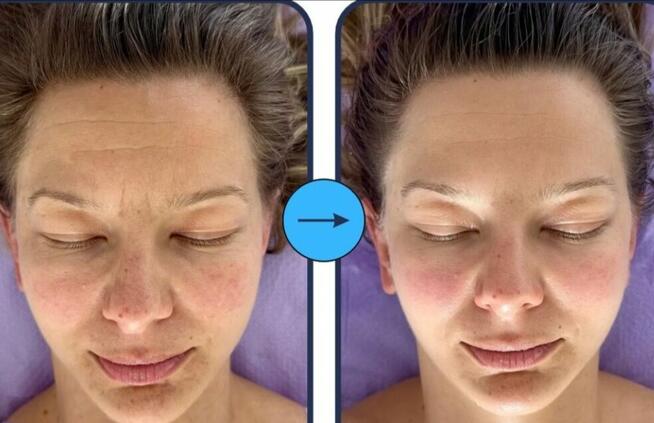 Mobilny Masaż Twarzy Kobido