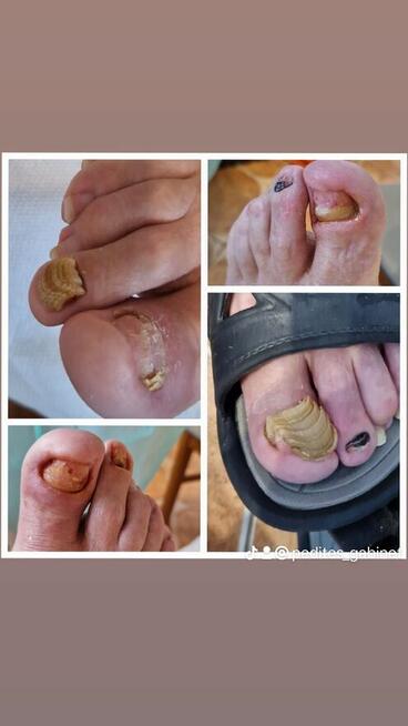 Mobilny gabinet podologiczny