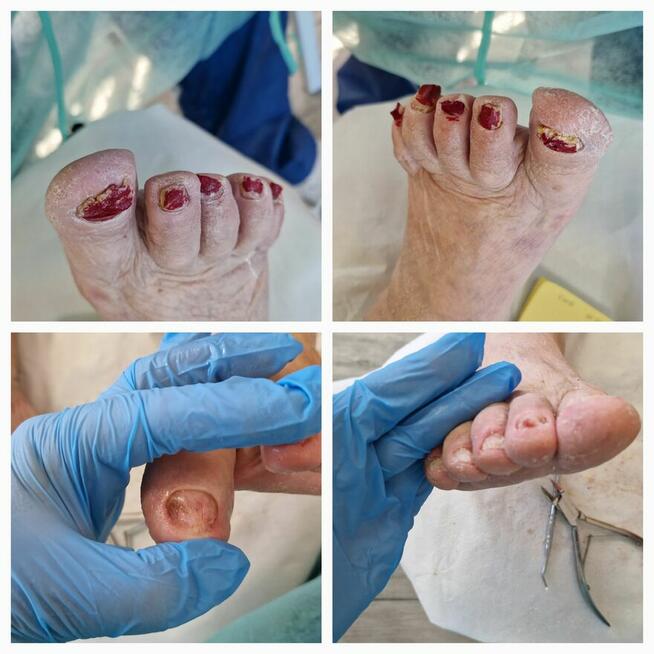 Mobilny gabinet podologiczny