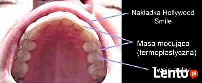 Piękne, równe i wybielone zęby w 5 minut...