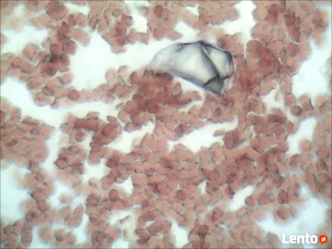 Analiza żywej kropli krwi Rzeszów