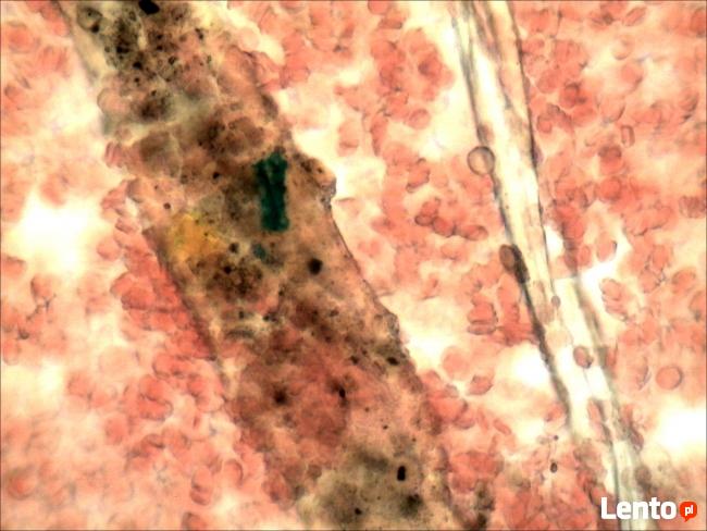 Analiza żywej kropli krwi Rzeszów