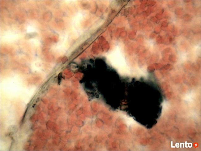 Analiza żywej kropli krwi Rzeszów