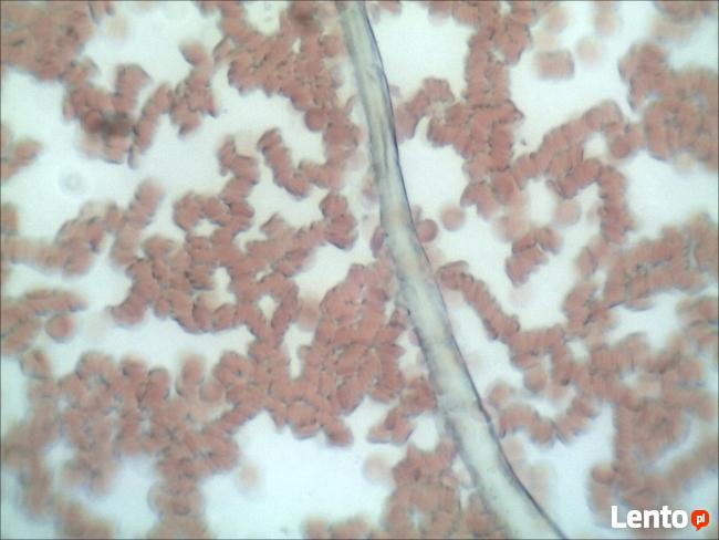 Analiza żywej kropli krwi Rzeszów