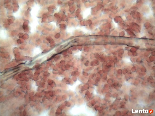 Analiza żywej kropli krwi Rzeszów