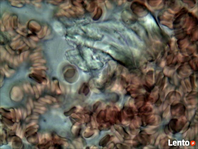 Analiza żywej kropli krwi Rzeszów